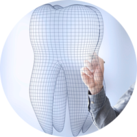 prothèse dentaire impression 3D